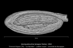 Quinqueloculina tenagos