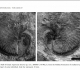 Fossile d'Argonauta absyrtus trouvé à Chypre - David M. Martill and Michael J. Barker in Paleontology (2006)