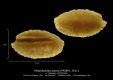 Platycephalus-janeti-