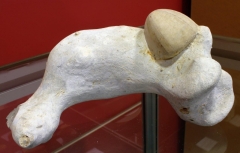 Conulus subrotondus - Turonien - Le Tréport