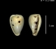 Multiples attaques sur une Marginella nitidula adulte de Fontenay en Vexin. *Cette espèce (208 - 16), au test mince, pouvant atteindre 15mm, citée à Grignon, est très rare.